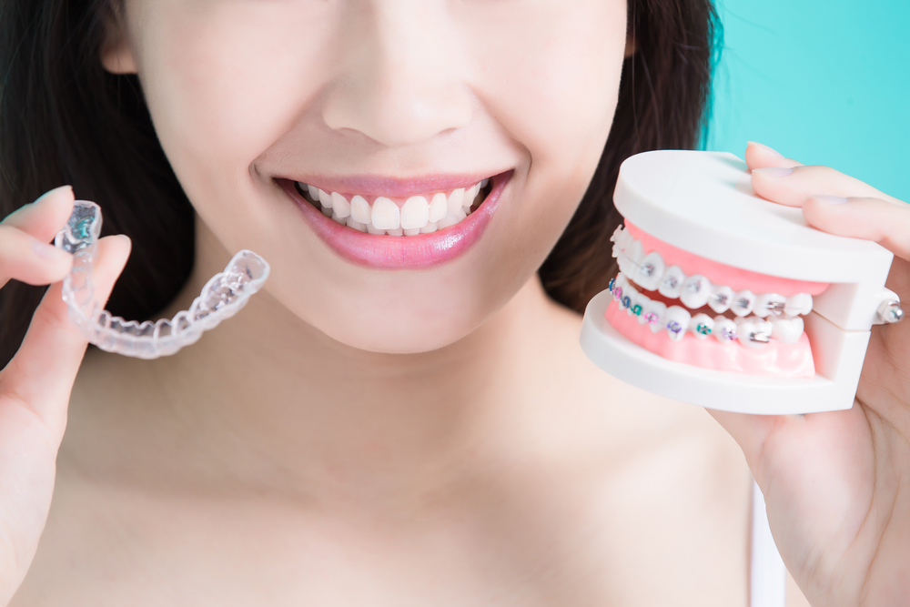 braces and invisalign near you