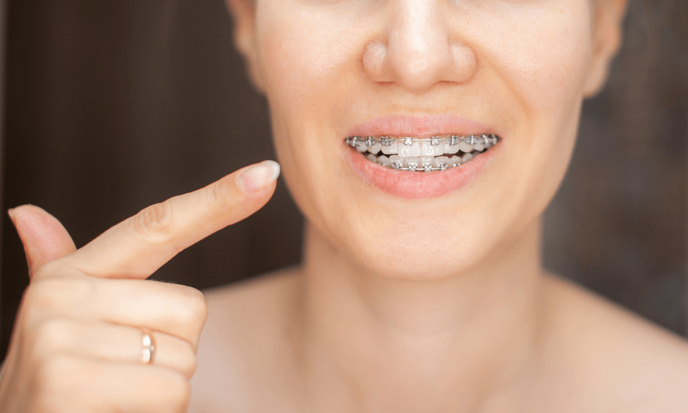 dental care orthodontics and your health near you 1