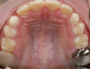 After orthodontic care