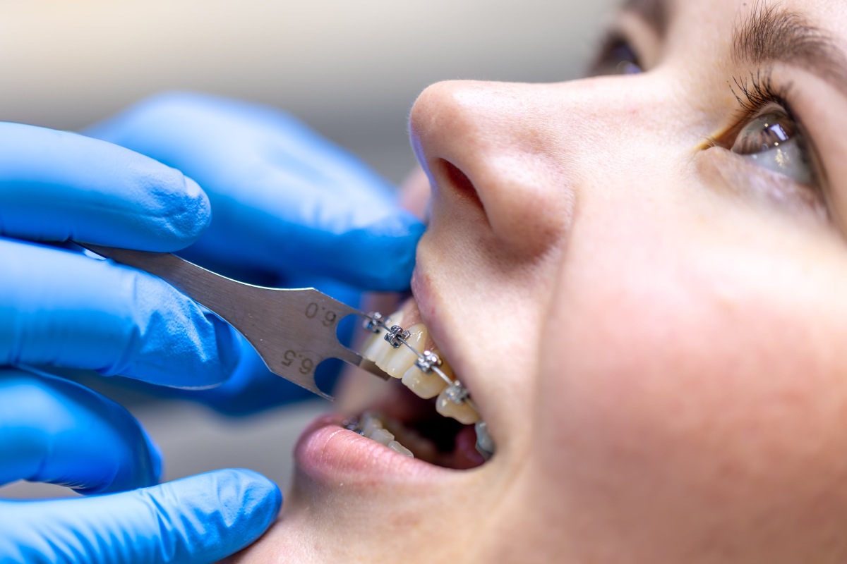 dental care orthodontics maple