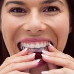 a lady is putting invisalign on her teeth