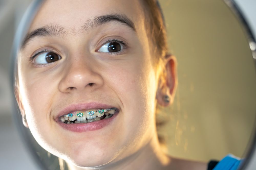 two phase orthodontic treatment for a healthy confident smile