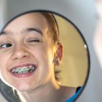 Life with braces.