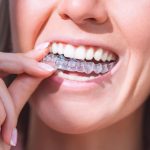 modern solution for a beautiful smile