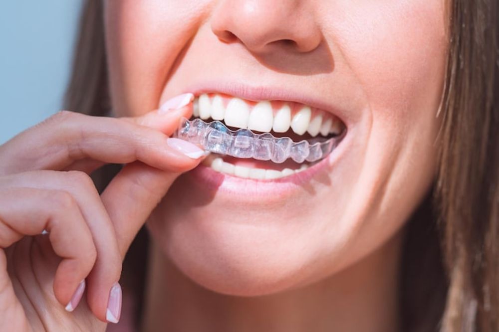 modern solution for a beautiful smile