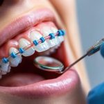 Neuromuscular Orthodontics